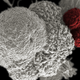 Above, a cancer cell (white) being attacked by T-cells (red). Image: National Institutes of Health